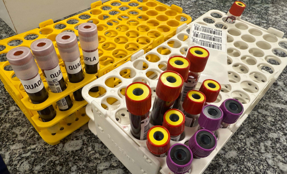 Saúde inicia campanha “Doe Sangue Pelo Esporte” em parceria com a Prefeitura de Curitiba e times de futebol paranaenses