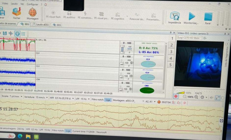 Hospital Regional do Sudoeste inicia testes para implantação da UTI Neonatal Neurológica, pioneira na rede estadual