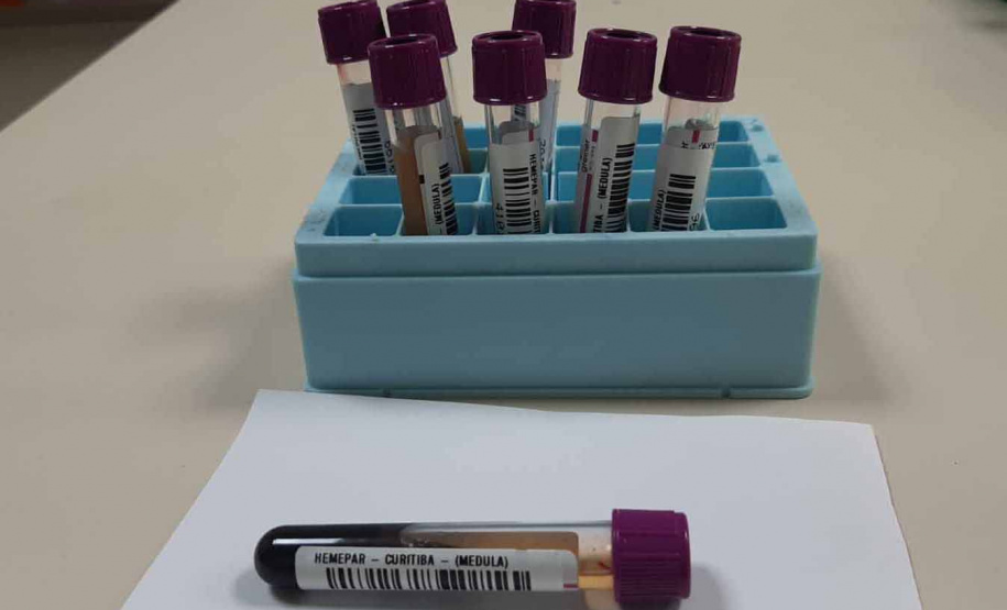 Fevereiro Laranja: a luta contra a leucemia e a importância do diagnóstico precoce