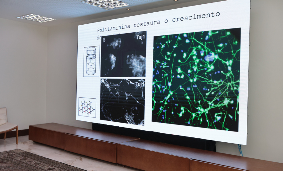 Hospitaldo Trabalhador realiza a primeira aplicação de polilamimina