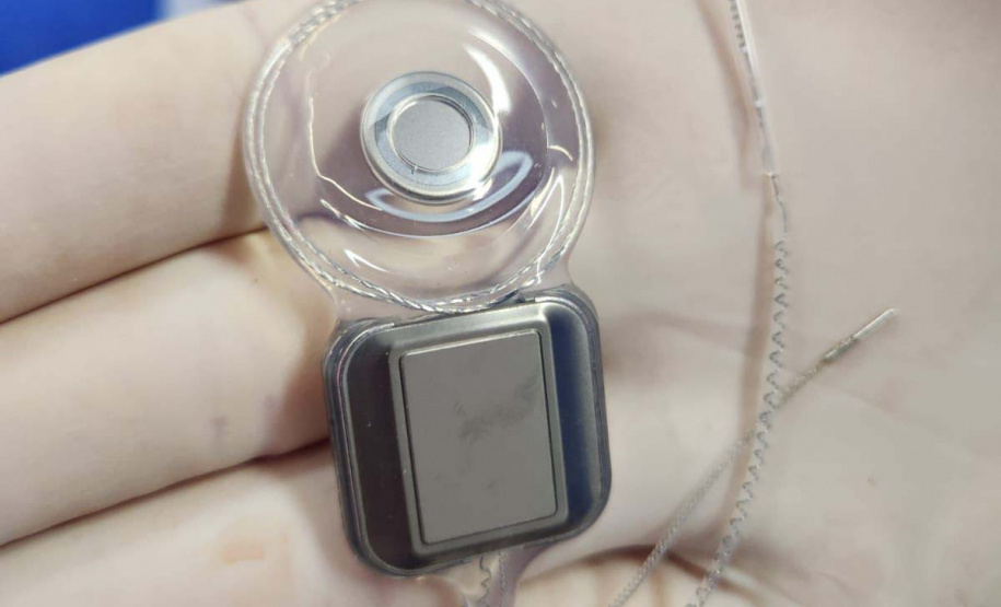 Paraná assume liderança nacional em implantes cocleares pelo SUS