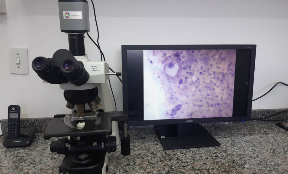 Paraná avança no combate ao câncer de colo do útero com ampliação da oferta do exame DNA-HPV para todo o Estado