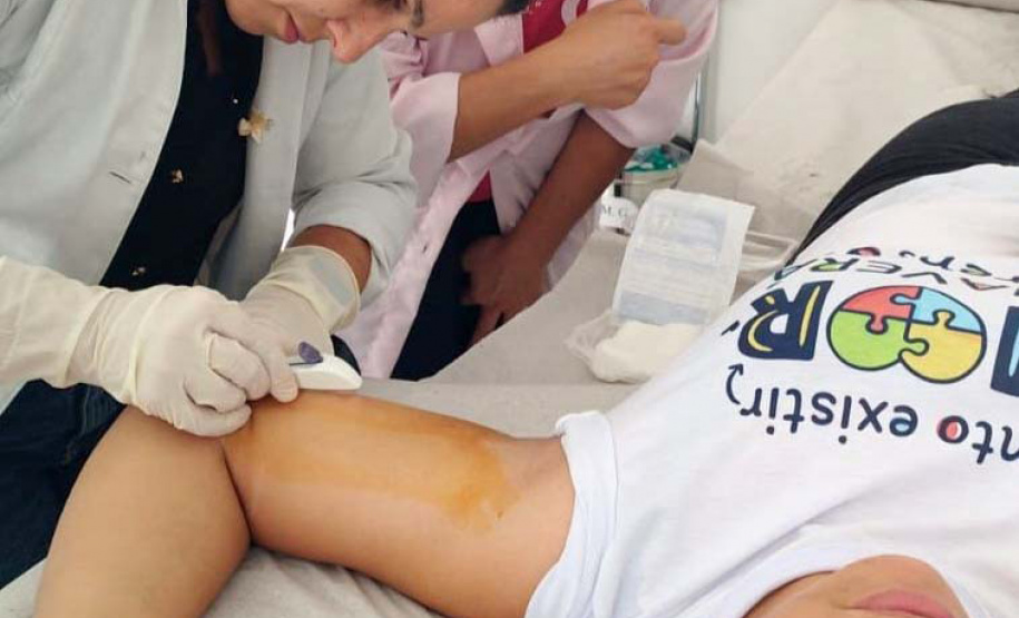 Com quase 6 mil inserções em 2026, Estado intensifica treinamento de implante contraceptivo para o interior