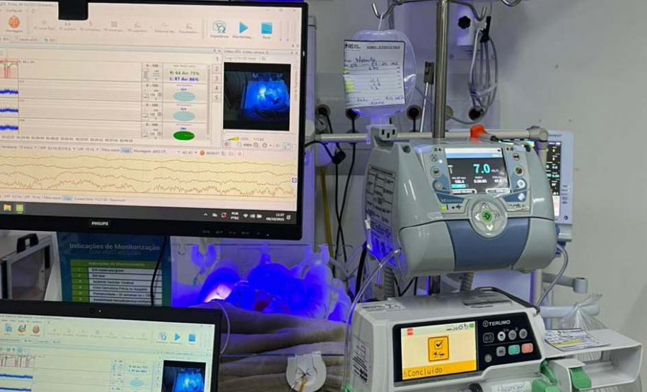 Hospitais da rede estadual implantam primeira UTI Neonatal Neurológica