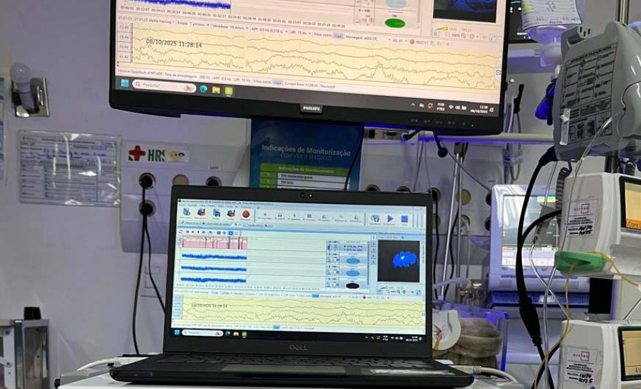 Hospitais da rede estadual implantam primeira UTI Neonatal Neurológica