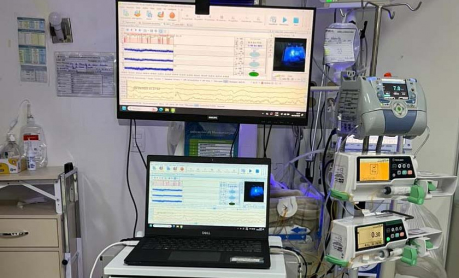 Hospitais da rede estadual implantam primeira UTI Neonatal Neurológica