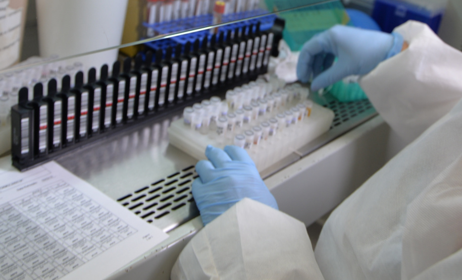 Saúde confirma vírus da febre amarela em macacos mortos. Foto: Arquivo/ANPr