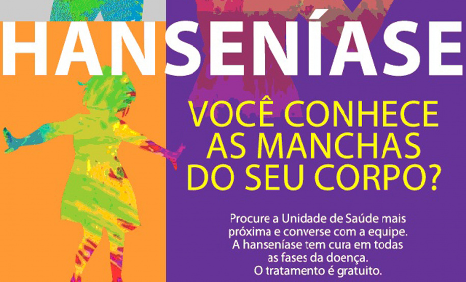 A hanseníase é silenciosa e pode demorar anos para apresentar os primeiros sintomas. Por isso é tão importante estar sempre atento aos sintomas, que podem facilmente passar despercebidos, ou ser confundidos com problemas passageiros. Foto: Arquivo/ANPr