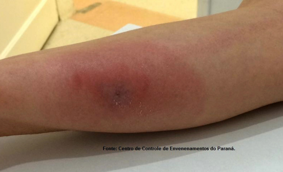 Aranha Marrom  -  Foto: Centro de Controle de Envenenamento do Paraná