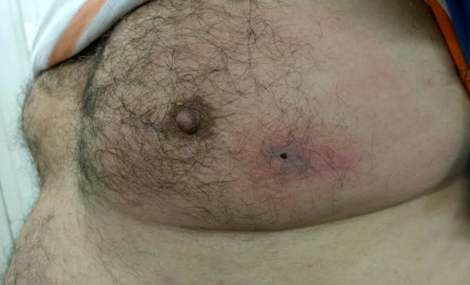 Aranha Marrom  -  Foto: Centro de Controle de Envenenamento do Paraná