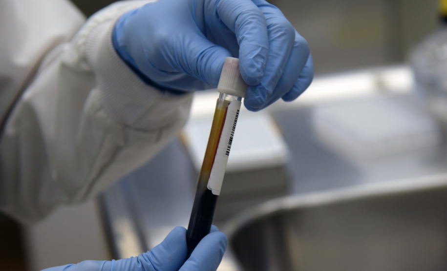 Marco de excelência nos serviços de saúde no Paraná, o Laboratório Central do Estado do Paraná (Lacen) se tornou também referência nacional para determinados exames, como os de resistência microbiana. Foto: Antonio Américo/SESA - 13/05/2019
