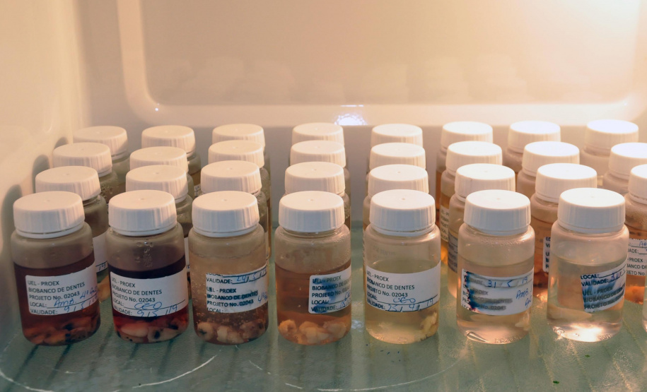 Biobanco da UEL acumula 300 dentes humanos doados. Foto:UEL