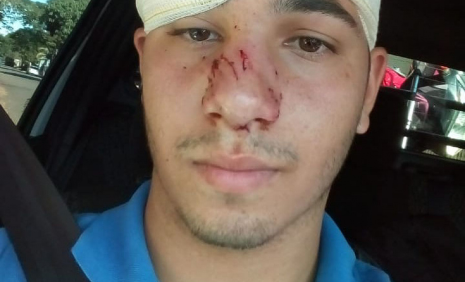 Em junho, foi registrado em Foz um caso grave de ataque. Mesmo preso dentro do imóvel, o cachorro conseguiu atacar o leiturista Saimon Marcos Pereira por uma brecha no muro.Foto: Divulgação/Sanepar