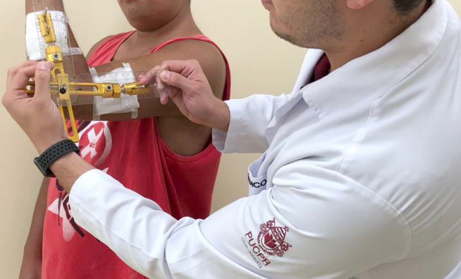 Depois de ficar cerca de três anos com graves limitações nos movimentos do cotovelo esquerdo, provocado por uma luxação crônica, hoje Maikon Teixeira da Costa, de 31 anos, já se permite pentear os cabelos e levar a mão à boca. Foto: Divulgação/SESA