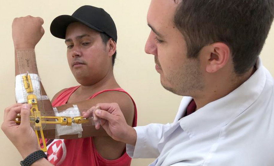 Depois de ficar cerca de três anos com graves limitações nos movimentos do cotovelo esquerdo, provocado por uma luxação crônica, hoje Maikon Teixeira da Costa, de 31 anos, já se permite pentear os cabelos e levar a mão à boca. Foto: Divulgação/SESA