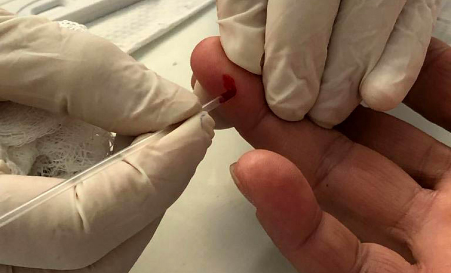 A Secretaria da Saúde do Paraná promove neste mês diversas ações da campanha Julho Amarelo, que visa conscientizar a população sobre a prevenção e tratamento das hepatites virais. Uma das principais atividades aconteceu nesta quinta-feira (25), em Curitiba, com a oferta de testes rápidos para diagnóstico das hepatites B e C. Foto: Divulgação/SESA