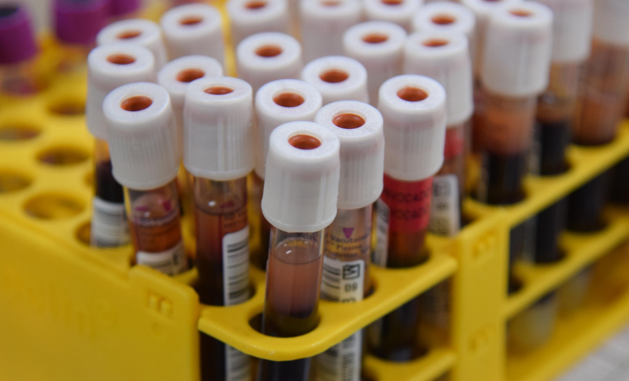 A Secretaria de Estado da Saúde celebra nesta segunda-feira (25) o Dia Nacional do Doador de Sangue ressaltando a importância deste ato de amor e solidariedade.

O Hemepar é o órgão responsável no Paraná pela coleta, armazenamento, processamento, transfusão e distribuição de sangue para 385 hospitais públicos, privados e filantrópicos, além de atender 92,8% de leitos SUS no Estado. FOTO: Divulgação/SESA