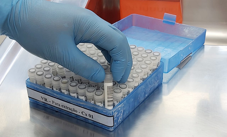 Saiba como é feito o exame para detectar o novo coronavírus no Paraná. Foto:SESA