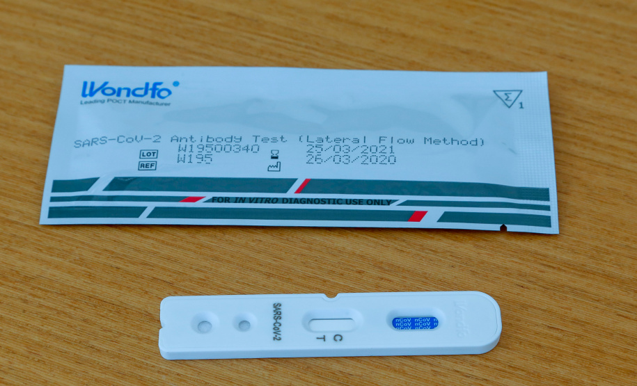 Governo distribui mais 178 mil testes rápidos aos municípios