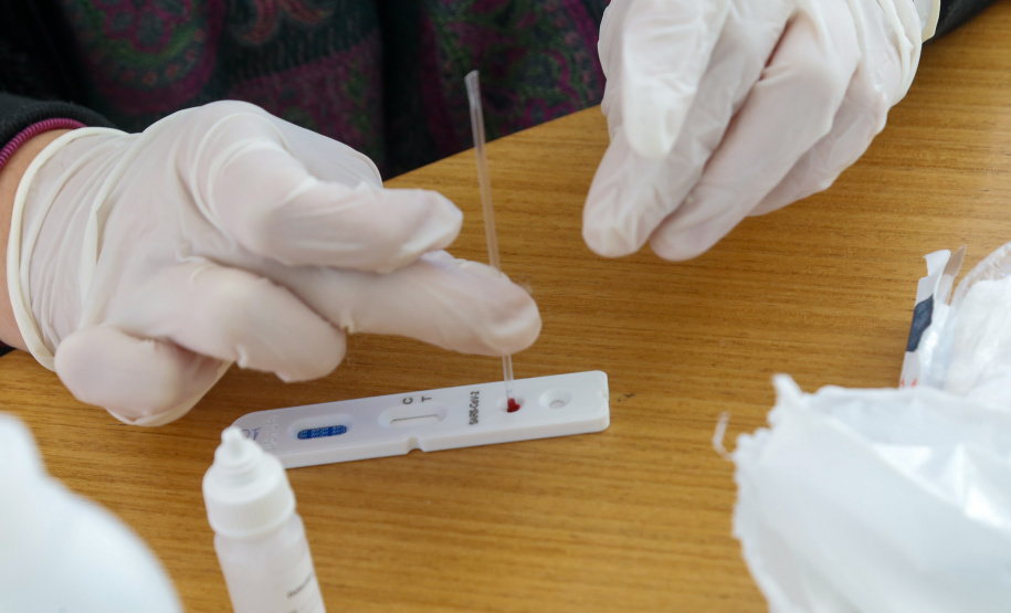 Governo distribui mais 178 mil testes rápidos aos municípios