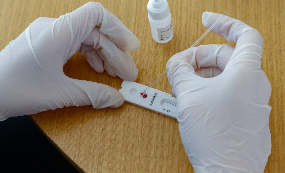 Governo distribui mais 178 mil testes rápidos aos municípios