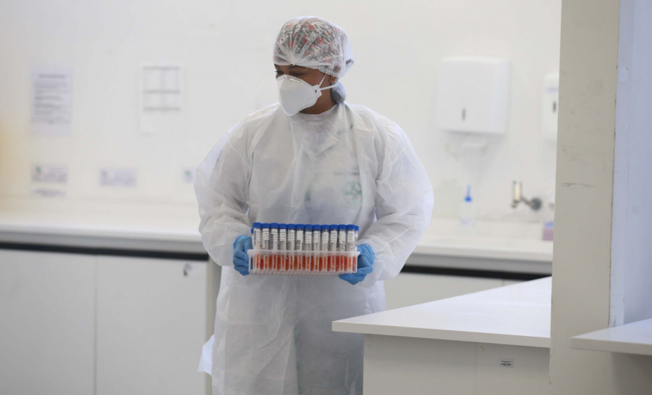 Governo do Paraná já investiu R$ 400 milhões no combate ao Coronavírus