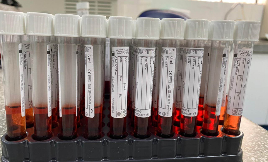 CPPI produziu mais de 100 mil tubos para transporte viral dos testes da Covid-19. Foto:SESA