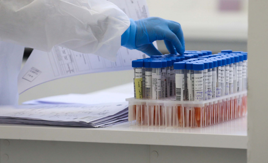 Paraná é o segundo estado em quantidade de exames RT-PCR. Foto: Geraldo Bubniak/AEN