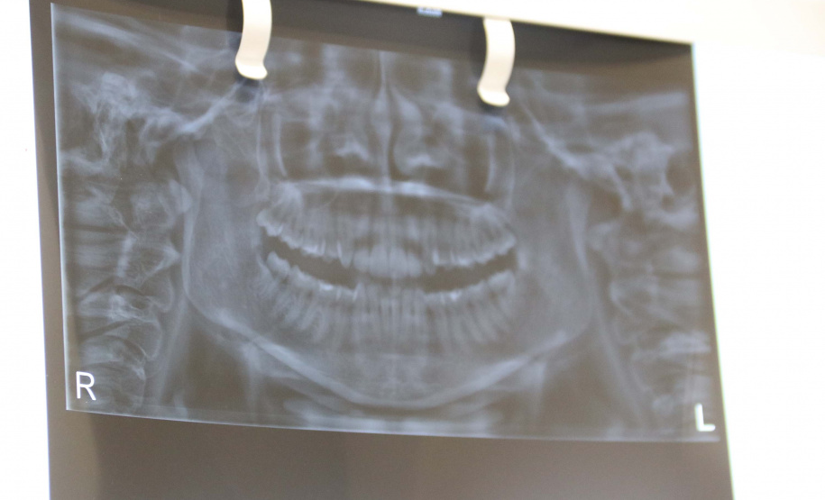 Polícia Científica e CRO iniciam campanha sobre a identificação humana pela Odontologia ForenseFoto:SESP