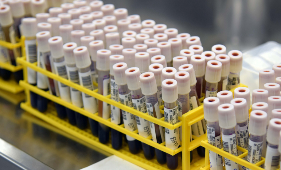 Saúde orienta sobre diagnóstico diferencial da dengue e Covid-19. Foto:SESA