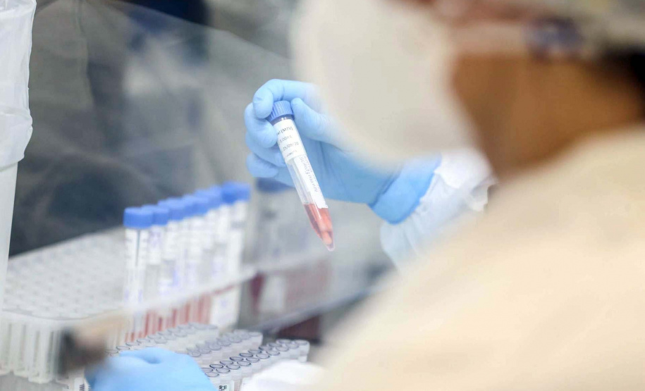 O sequenciamento genômico do vírus foi feito pela Fundação Oswaldo Cruz (Fiocruz) Rio de Janeiro. Destes novos casos, 15 foram identificados como sendo da P1, já circulante no Paraná e dois casos da variante B.1.1.7, identificada no Reino Unido.