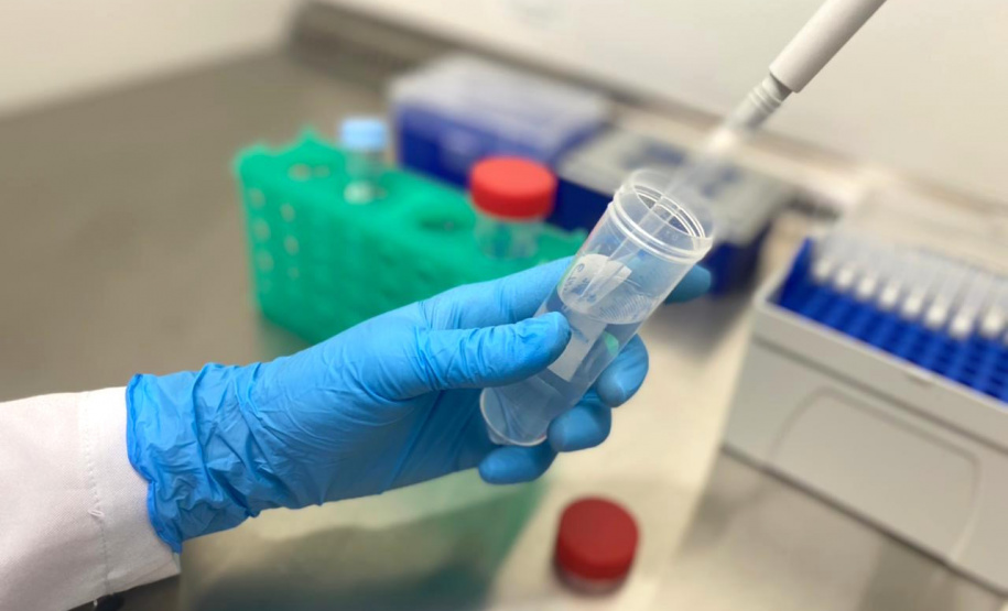 O Governo do Estado do Paraná lançou Chamada Pública para concessão de bolsas de extensão para profissionais da área da Saúde. Os bolsistas vão contribuir para ampliar a capacidade de pesquisas de diagnóstico molecular do novo coronavírus, dando suporte nos processos de testagem de amostras de pacientes para confirmação dos casos de Covid-19.  - Curitiba, 09/03/2021 -  Foto: divulgação SETI