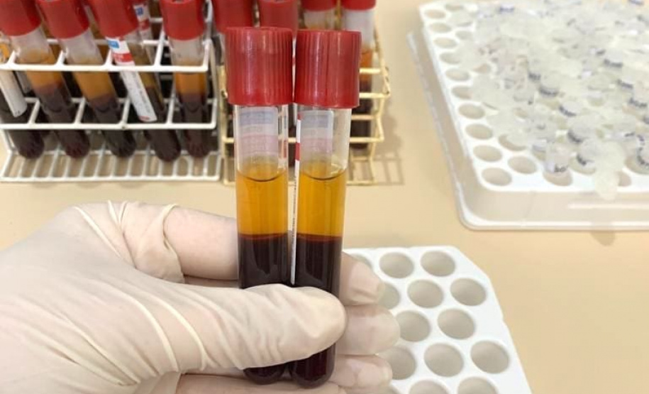 Pesquisa pretende prever possíveis pandemias provocadas pela relação do homem com os animais
. Foto: Adapar