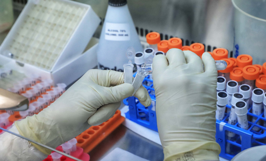 Paraná mantém liderança nacional em testagem padrão ouro para detecção da Covid-19. Foto: José Fernando Ogura/AEN