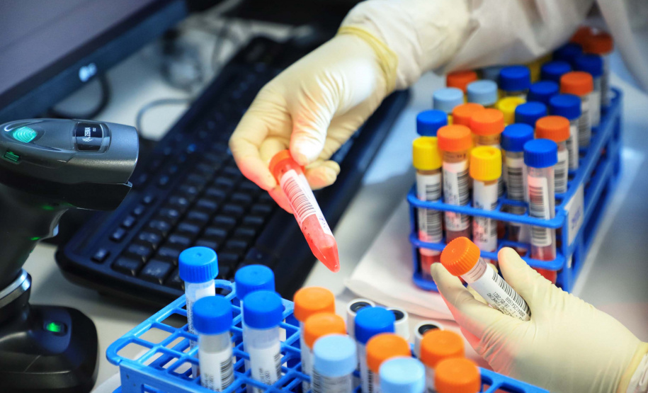 Paraná mantém liderança nacional em testagem padrão ouro para detecção da Covid-19. Foto: José Fernando Ogura/AEN