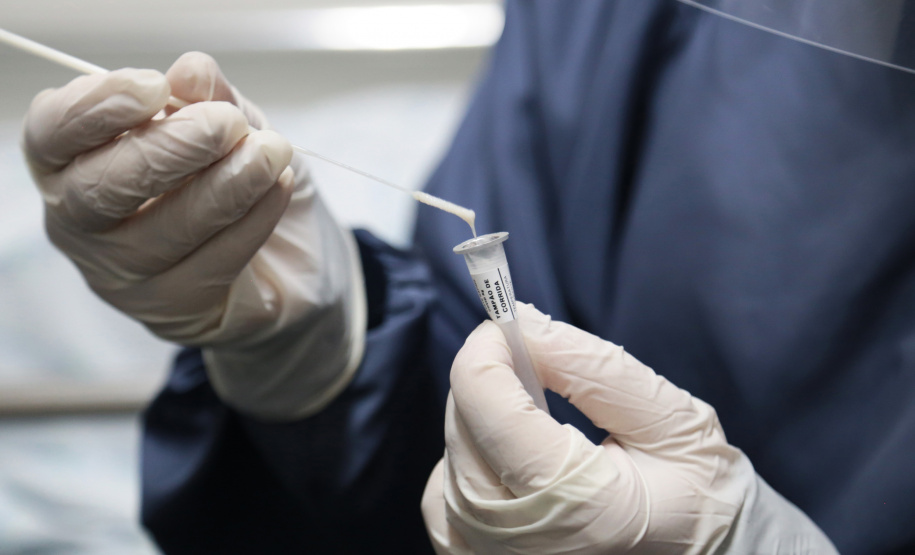 O Complexo Hospitalar do Trabalhador (CHT) irá utilizar mil testes rápidos para diagnóstico da Covid-19 em pacientes e colaboradores nas unidades que compõem o complexo, como o Hospital do Trabalhador, Hospital de Reabilitação, Hospital de Infectologia e Retaguarda Clínica, Hospital da Lapa, e Hospital Regional do Litoral. -  Curitiba, 21/05/2021  -  Foto: Clevis Massolia/CHT