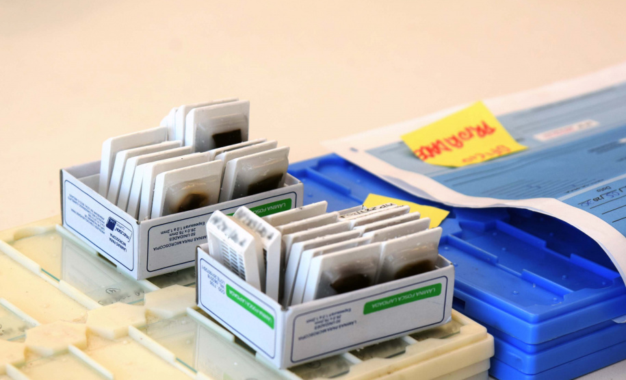 Um Termo de Cooperação Técnica firmado nesta terça-feira (25) entre a Polícia Científica e o Complexo Hospitalar do Trabalhador (CHT) vai permitir o uso compartilhado do laboratório multiusuário de patologia forense do Instituto Médico Legal (IML). Foto: Américo Antonio/SESA