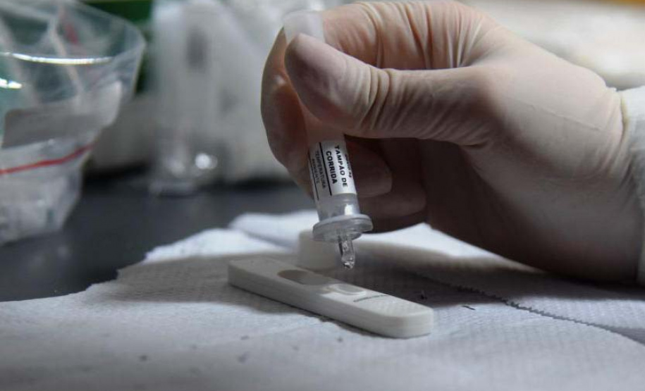 Paraná realiza estratégia de testagem para Covid-19 no aeroporto internacional Afonso Pena. Foto: Américo Antonio/SESA