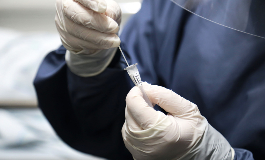 A Secretaria de Estado da Saúde (Sesa) está enviando 85 mil testes rápidos imunocromatográficos para pesquisa do antígeno viral SARS-CoV-2 e 640 oxímetros aos municípios sede das 22 Regionais de Saúde, quatro municípios de fronteira, além de todos os municípios do litoral do Paraná. O objetivo é fortalecer o rastreio, monitoramento e isolamento de contatos relacionados à Covid-19.  -  Curitiba, 09/06/2021  -  Foto: Clevis Massolla