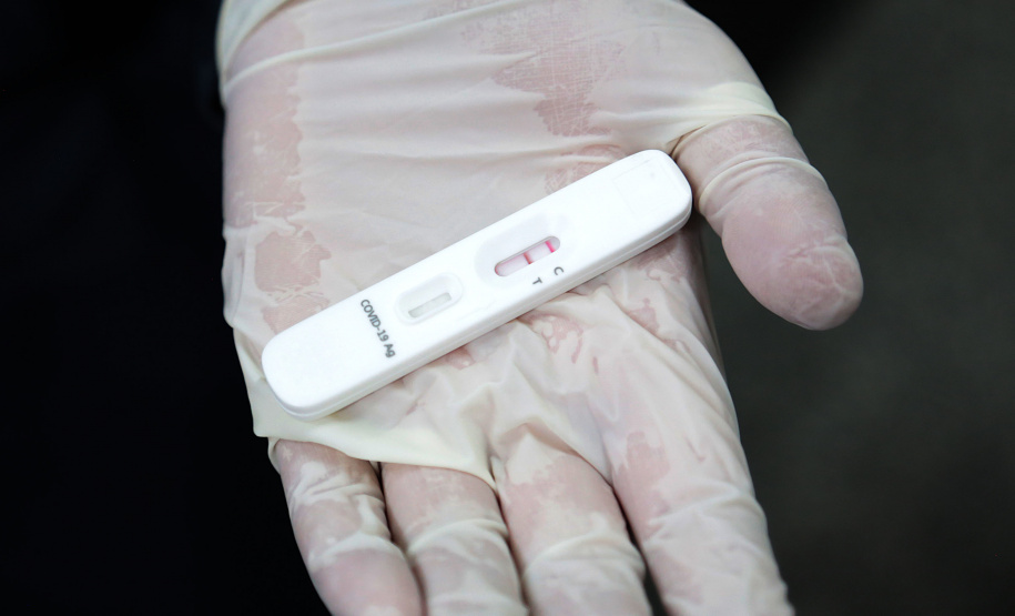 A Secretaria de Estado da Saúde (Sesa) está enviando 85 mil testes rápidos imunocromatográficos para pesquisa do antígeno viral SARS-CoV-2 e 640 oxímetros aos municípios sede das 22 Regionais de Saúde, quatro municípios de fronteira, além de todos os municípios do litoral do Paraná. O objetivo é fortalecer o rastreio, monitoramento e isolamento de contatos relacionados à Covid-19.  -  Curitiba, 09/06/2021  -  Foto: Clevis Massolla