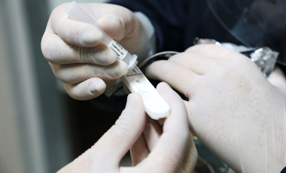 A Secretaria de Estado da Saúde (Sesa) está enviando 85 mil testes rápidos imunocromatográficos para pesquisa do antígeno viral SARS-CoV-2 e 640 oxímetros aos municípios sede das 22 Regionais de Saúde, quatro municípios de fronteira, além de todos os municípios do litoral do Paraná. O objetivo é fortalecer o rastreio, monitoramento e isolamento de contatos relacionados à Covid-19.  -  Curitiba, 09/06/2021  -  Foto: Clevis Massolla