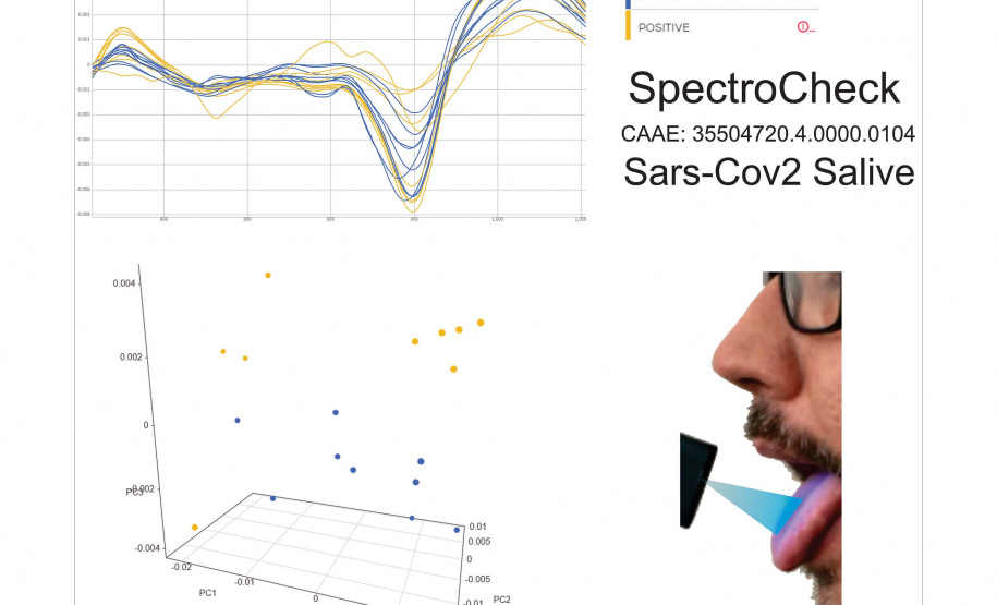 Padrão amarelo reflete partículas presentes nos casos positivos de Covid-19; padrão azul reflete resultado negativos - Maringá, 18/06/2021 - Foto/Arte: UEM