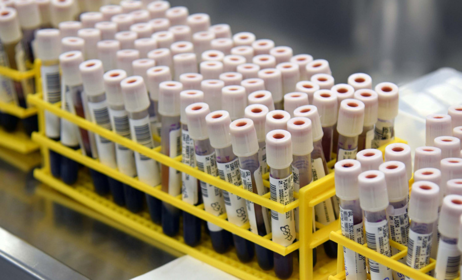 Um estudo desenvolvido por pesquisadores da Universidade Estadual de Maringá (UEM) busca identificar a reação cruzada entre testes positivos da dengue e da Covid-19.  -  Foto: UEM/SETI