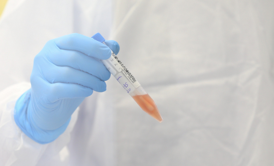 Paraná confirma mais um caso da variante delta; mulher morava em São José dos Pinhais
Foto: Geraldo Bubniak/AEN