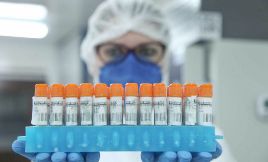 UEPG realiza estudo para identificar variantes da Covid-19 em pacientes do Hospital Universitário  -  Ponta Grossa, 13/08/2021  -  Foto: Jéssica Natal/UEPG