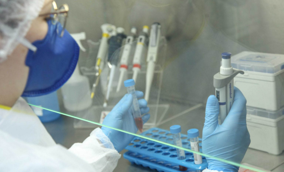 UEPG realiza estudo para identificar variantes da Covid-19 em pacientes do Hospital Universitário  -  Ponta Grossa, 13/08/2021  -  Foto: Jéssica Natal/UEPG