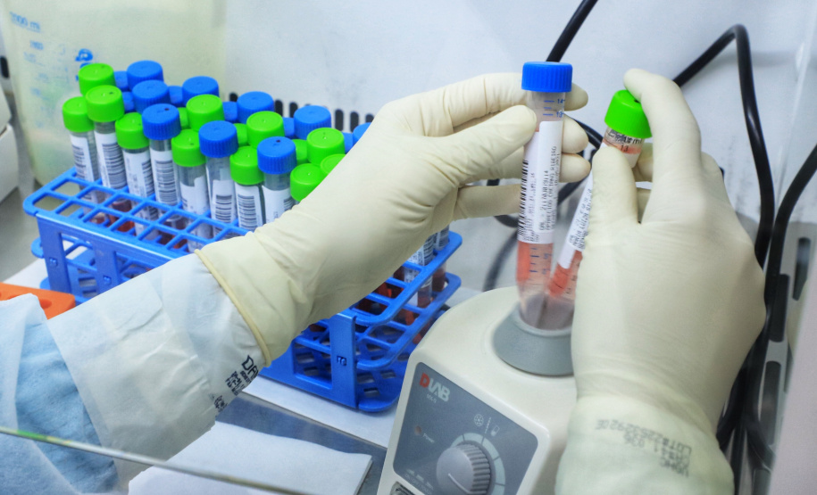 O Laboratório de Análises Clínicas do Hospital Universitário Regional de Maringá (LAC-HUM) já realizou, desde o início da pandemia até a segunda semana de agosto de 2021, quase seis mil testes para detectar a presença do novo coronavírus
Foto: José Fernando Ogura/AEN