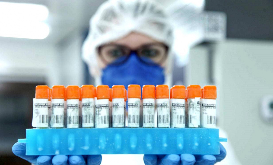 UEPG realiza estudo para identificar variantes da Covid-19 em pacientes do Hospital Universitário - Ponta Grossa, 13/08/2021 - Foto: Jéssica Natal/UEPG Uma Chamada Pública do Governo do Estado do Paraná, lançada nesta segunda-feira (23)
pela Superintendência Geral de Ciência, Tecnologia e Ensino Superior (Seti), em parceria com
a Fundação Araucária de Apoio ao Desenvolvimento Científico e Tecnológico, vai destinar R$ 8
milhões para projetos de Pesquisa Básica e Aplicada de diversas áreas do conhecimento. - Curitiba, 23/08/2021 - Ponta Grossa, 13/08/2021 - Foto: Jéssica Natal/UEPG