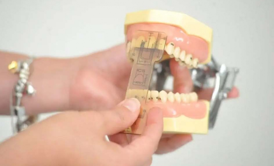 UEL licencia tecnologia e viabiliza produção de três novas ferramentas para Odontologia Restauradora. Foto: UEL