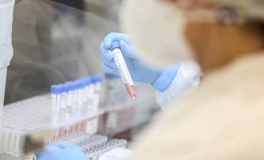 lacen gov Saúde confirma mais 17 casos e seis óbitos da variante delta - Curitiba, 01/10/2021 - Foto: Geraldo Bubniak/AEN